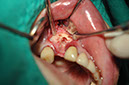 %_tempFileNameImplant%2085b2%
