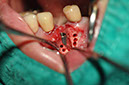 %_tempFileNameImplant%2085b3%