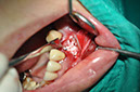 %_tempFileNameImplant%2085b4%