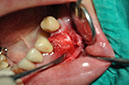 %_tempFileNameImplant%2085b5%