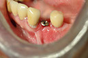 %_tempFileNameImplant%2085c1%