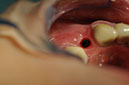 %_tempFileNameImplant%2085c2%