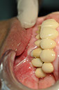 %_tempFileNameImplant%2085d1%