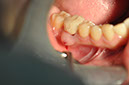 %_tempFileNameImplant%2086a1%