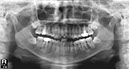%_tempFileNameImplant%2086a2%