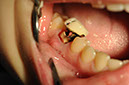 %_tempFileNameImplant%2086a3%