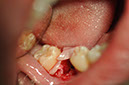 %_tempFileNameImplant%2086b1%