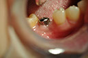 %_tempFileNameImplant%2086c1%