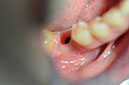 %_tempFileNameImplant%2086c2%