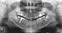 %_tempFileNameImplant%2086d1%