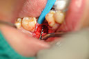 %_tempFileNameImplant%2088a2%