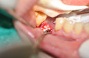 %_tempFileNameImplant%2088a4%
