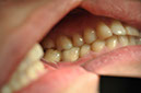 %_tempFileNameImplant%2088c3%