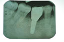 %_tempFileNameImplant%2088d1%