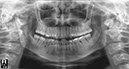 %_tempFileNameImplant%2088d2%