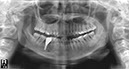 %_tempFileNameImplant%2088d4%