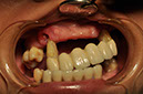 %_tempFileNameImplant%2089a1%