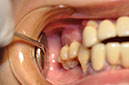 %_tempFileNameImplant%2089a2%