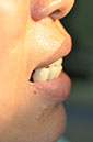 %_tempFileNameImplant%2089a6%