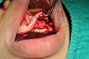 %_tempFileNameImplant%2089b1%