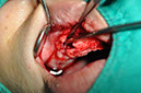 %_tempFileNameImplant%2089b2%