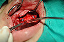 %_tempFileNameImplant%2089b3%