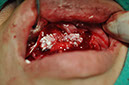 %_tempFileNameImplant%2089b4%