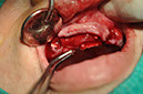 %_tempFileNameImplant%2089b5%