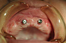 %_tempFileNameImplant%2089c1%
