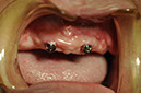 %_tempFileNameImplant%2089c2%