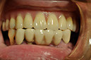 %_tempFileNameImplant%2089c5%