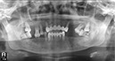 %_tempFileNameImplant%2089d1%