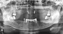 %_tempFileNameImplant%2089d2%