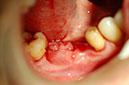 %_tempFileNameImplant%208c%