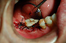%_tempFileNameImplant%208d%