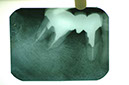 %_tempFileNameImplant%208j3%