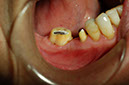 %_tempFileNameImplant%208m1%