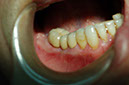 %_tempFileNameImplant%208n1%