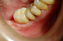 %_tempFileNameImplant%208o3%