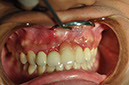 %_tempFileNameImplant%2090a1%