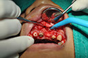 %_tempFileNameImplant%2090a4%