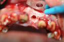 %_tempFileNameImplant%2090a5%