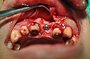 %_tempFileNameImplant%2090a6%
