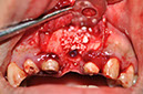%_tempFileNameImplant%2090a7%