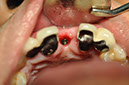 %_tempFileNameImplant%2090c7%