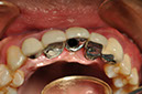 %_tempFileNameImplant%2090d2%