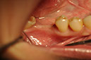 %_tempFileNameImplant%2090d4%