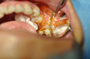 %_tempFileNameImplant%2091a1%