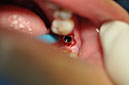 %_tempFileNameImplant%2091a2%