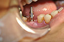%_tempFileNameImplant%2091a3%